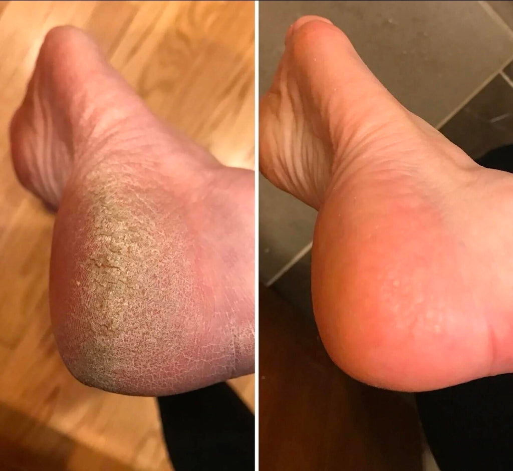 CLAM  Legacy Body Balm